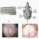 Illustration for article titled Transparent skull implant is the next step in body mods (and medicine)